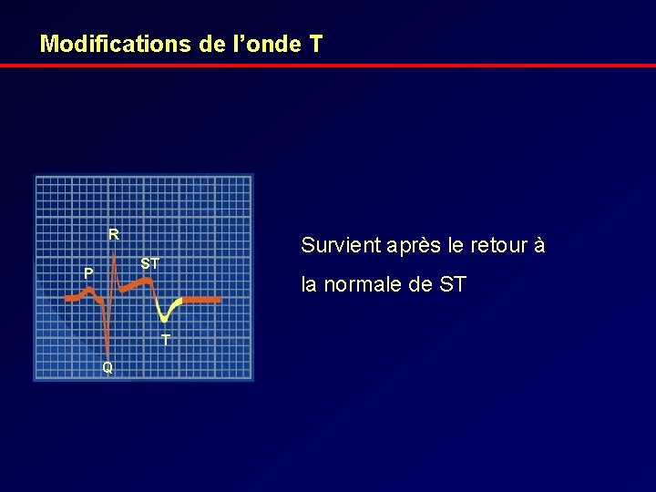 Modifications de l’onde T R Survient après le retour à ST P la normale