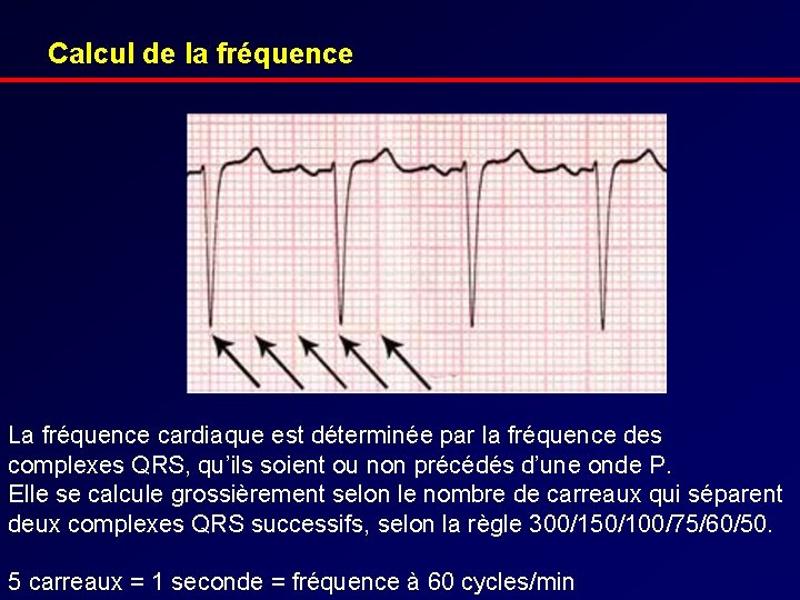 Calcul de la fréquence La fréquence cardiaque est déterminée par la fréquence des complexes