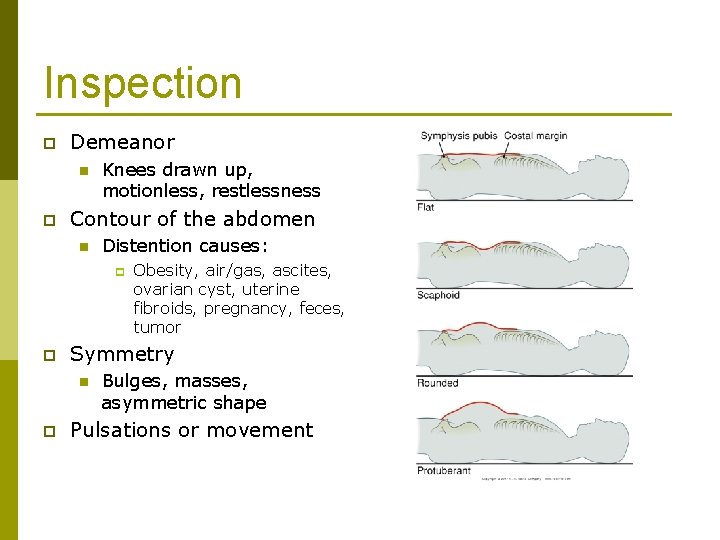 Inspection p Demeanor n p Knees drawn up, motionless, restlessness Contour of the abdomen