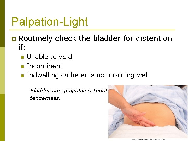 Palpation-Light p Routinely check the bladder for distention if: n n n Unable to