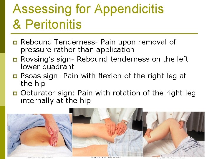 Assessing for Appendicitis & Peritonitis p p Rebound Tenderness- Pain upon removal of pressure