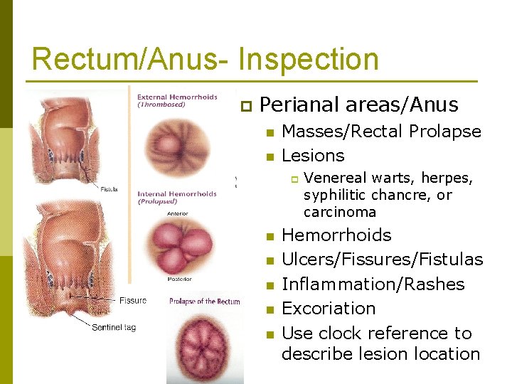 Rectum/Anus- Inspection p Perianal areas/Anus n n Masses/Rectal Prolapse Lesions p n n n