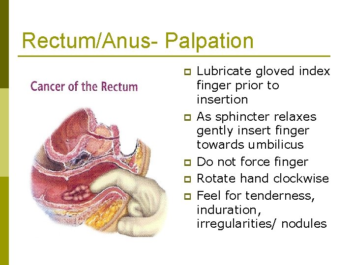 Rectum/Anus- Palpation p p p Lubricate gloved index finger prior to insertion As sphincter