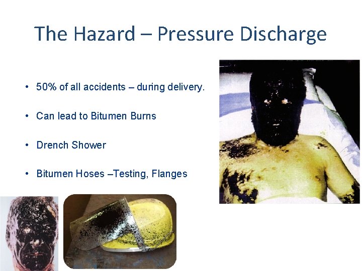 The Hazard – Pressure Discharge • 50% of all accidents – during delivery. •