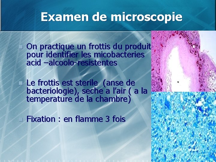 Examen de microscopie n On practique un frottis du produit pour identifier les micobacteries