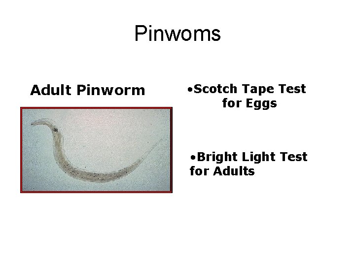 Pinwoms Adult Pinworm • Scotch Tape Test for Eggs • Bright Light Test for