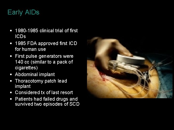 Early AIDs § 1980 -1985 clinical trial of first ICDs § 1985 FDA approved