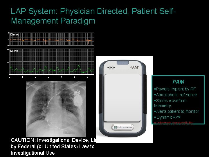 LAP System: Physician Directed, Patient Self. Management Paradigm §Jack PAM §Powers implant by RF
