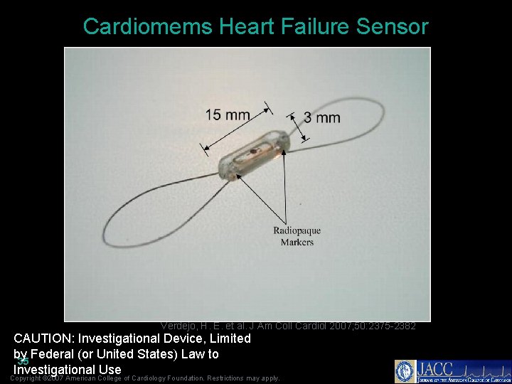 Cardiomems Heart Failure Sensor Verdejo, H. E. et al. J Am Coll Cardiol 2007;