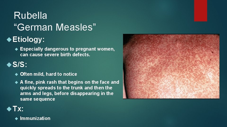 Rubella “German Measles” Etiology: Especially dangerous to pregnant women, can cause severe birth defects.
