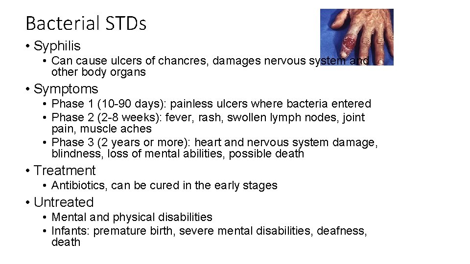 Bacterial STDs • Syphilis • Can cause ulcers of chancres, damages nervous system and