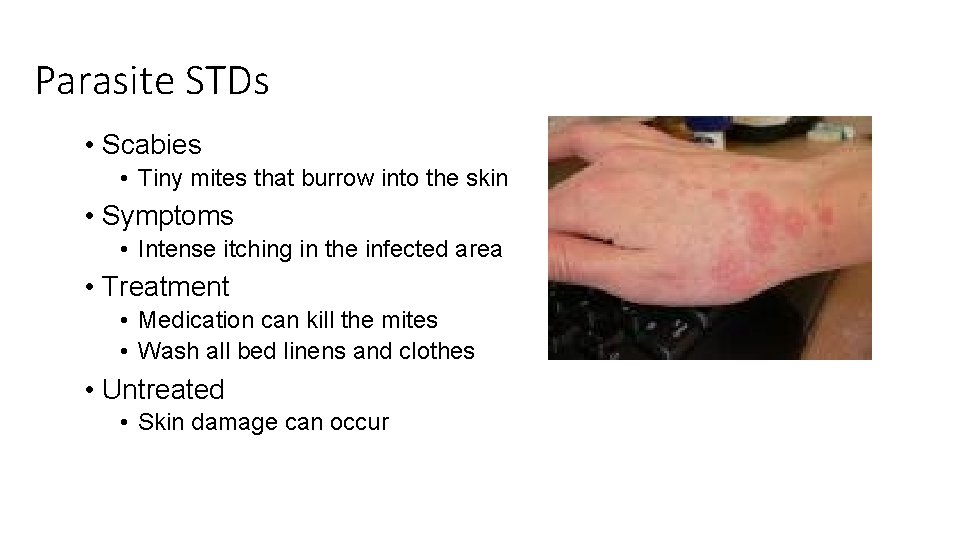 Parasite STDs • Scabies • Tiny mites that burrow into the skin • Symptoms