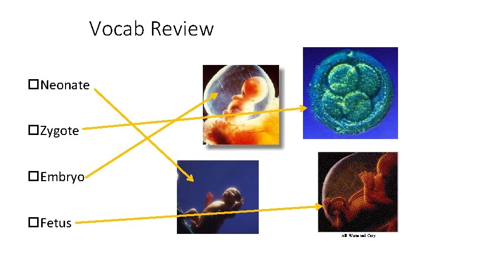 Vocab Review Neonate Zygote Embryo Fetus 