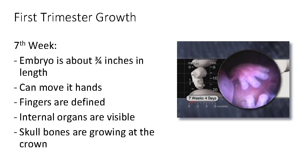 First Trimester Growth 7 th Week: - Embryo is about ¾ inches in length