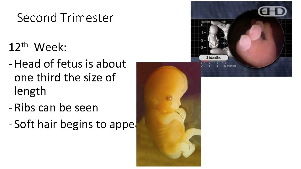 Second Trimester 12 th Week: - Head of fetus is about one third the