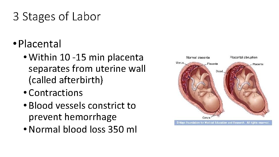 3 Stages of Labor • Placental • Within 10 -15 min placenta separates from