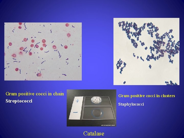 Gram positive cocci in chain Streptococci Gram positive cocci in clusters Staphylococci Catalase 