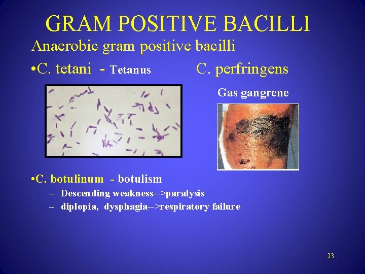 GRAM POSITIVE BACILLI Anaerobic gram positive bacilli • C. tetani - Tetanus C. perfringens