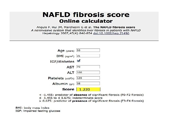 NAFLD fibrosis score 
