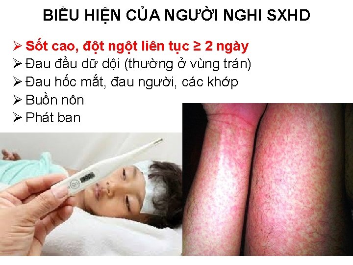 BIỂU HIỆN CỦA NGƯỜI NGHI SXHD Ø Sốt cao, đột ngột liên tục ≥ BIỂU HIỆN CỦA NGƯỜI NGHI SXHD Ø Sốt cao, đột ngột liên tục ≥