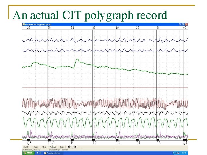 An actual CIT polygraph record 