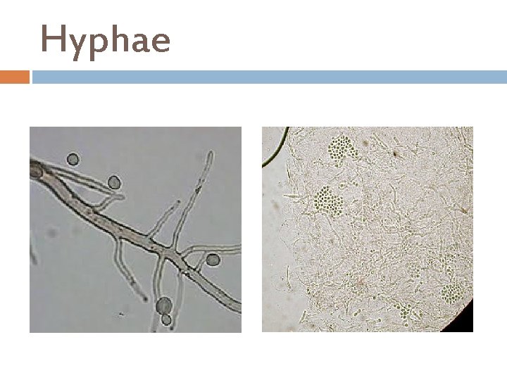 Hyphae 