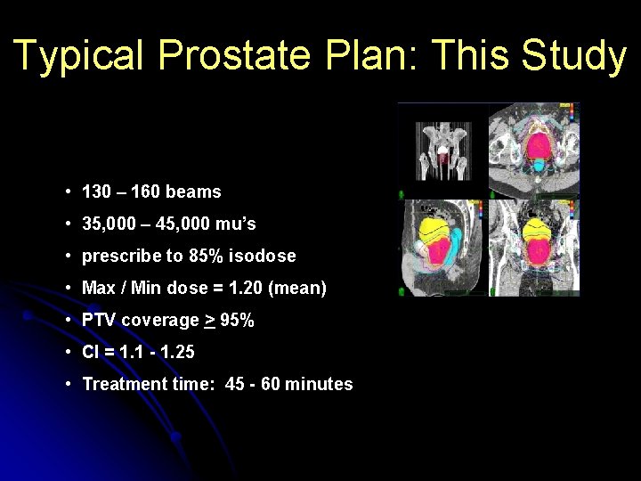 Typical Prostate Plan: This Study • 130 – 160 beams • 35, 000 –