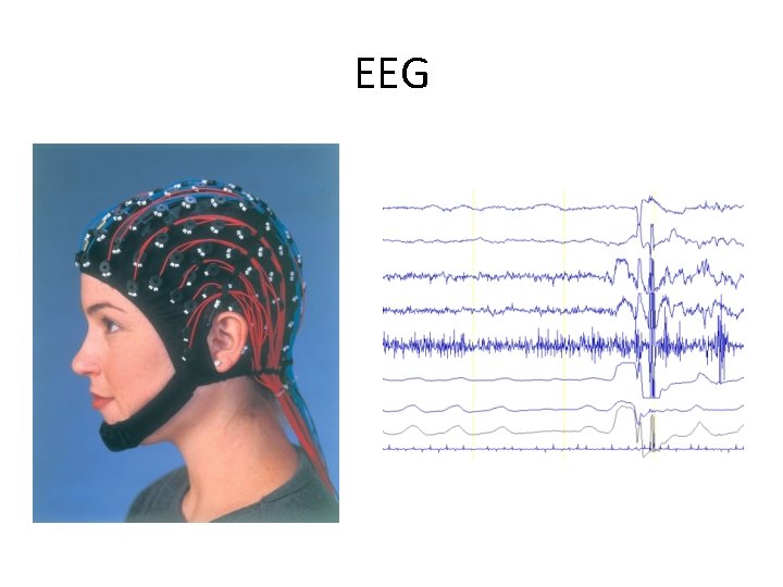 EEG 
