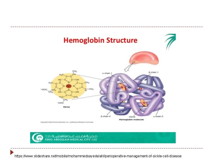 https: //www. slideshare. net/mobile/mohammedsayedalahl/perioperative-management-of-sickle-cell-disease 