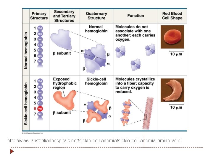 http: //www. australianhospitals. net/sickle-cell-anemia-amino-acid 