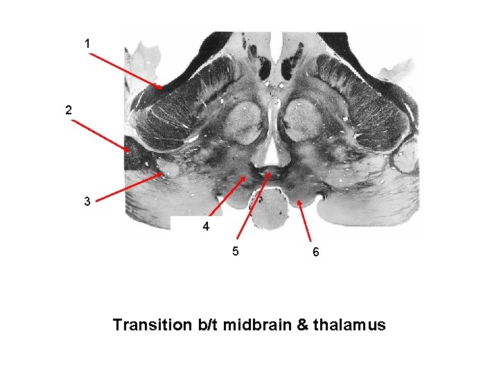 Optic tract 1 Lateral geniculate 2 nucleus Brachium of 3 Superior colliculi Pretectal area