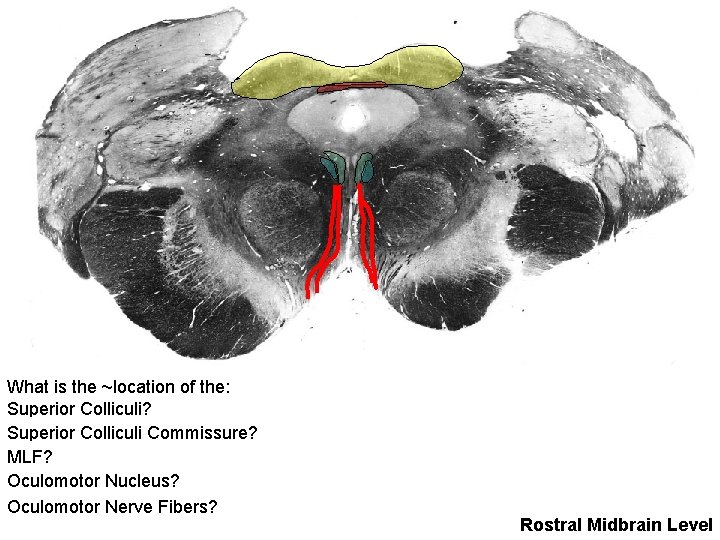 What is the ~location of the: Superior Colliculi? Superior Colliculi Commissure? MLF? Oculomotor Nucleus?