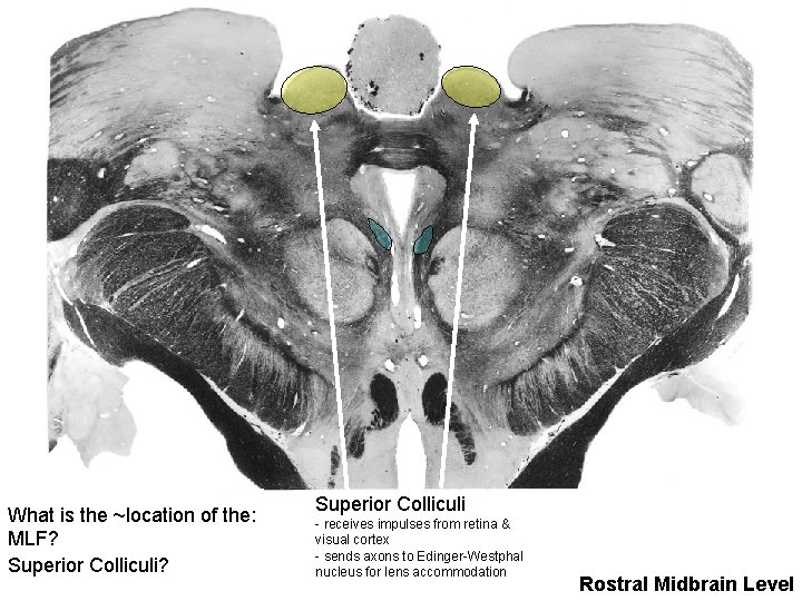 What is the ~location of the: MLF? Superior Colliculi? Superior Colliculi - receives impulses