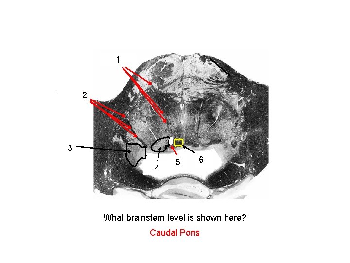 abducens nerve 1 fibers facial nerve fibers 2 Vestibular 3 Nuclei PPRF abducens 5