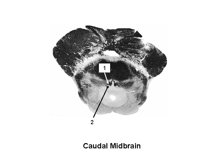 1 MLF trochlear 2 nucleus Caudal Midbrain 