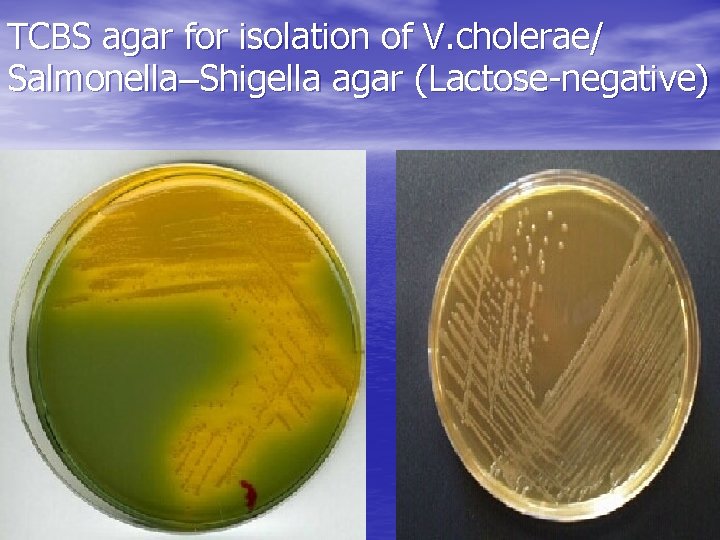 TCBS agar for isolation of V. cholerae/ Salmonella–Shigella agar (Lactose-negative) 