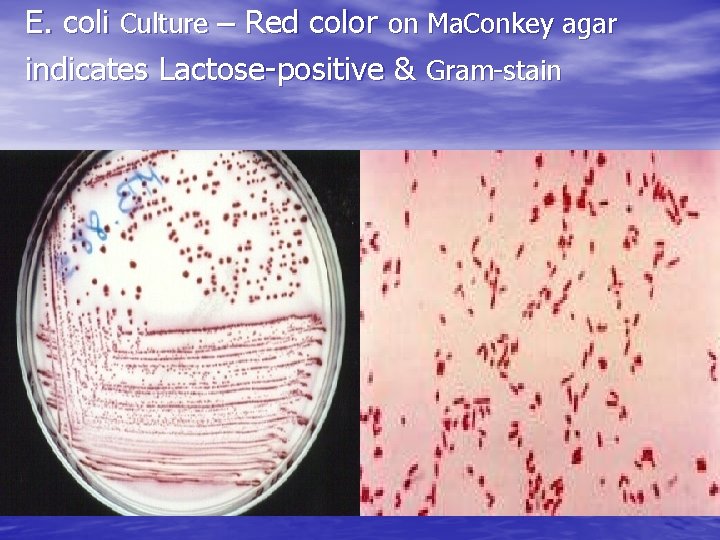 E. coli Culture – Red color on Ma. Conkey agar indicates Lactose-positive & Gram-stain