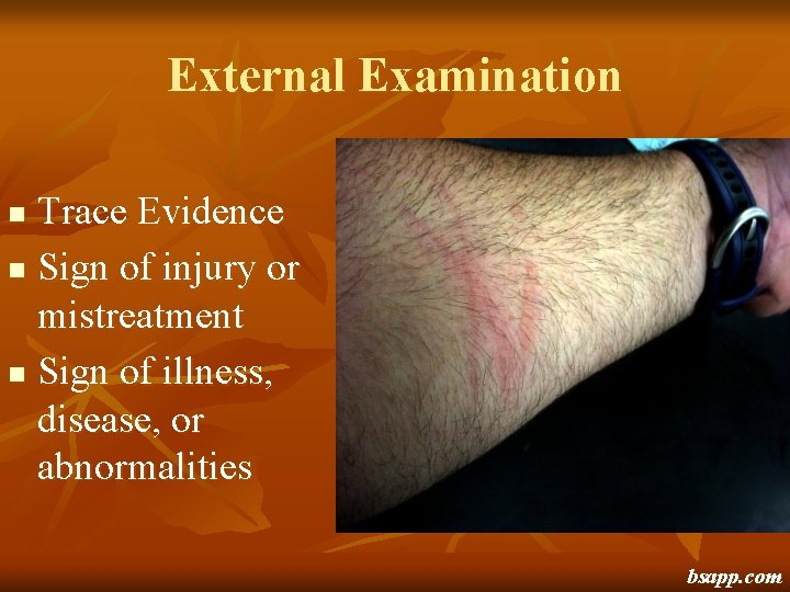 External Examination Trace Evidence n Sign of injury or mistreatment n Sign of illness,