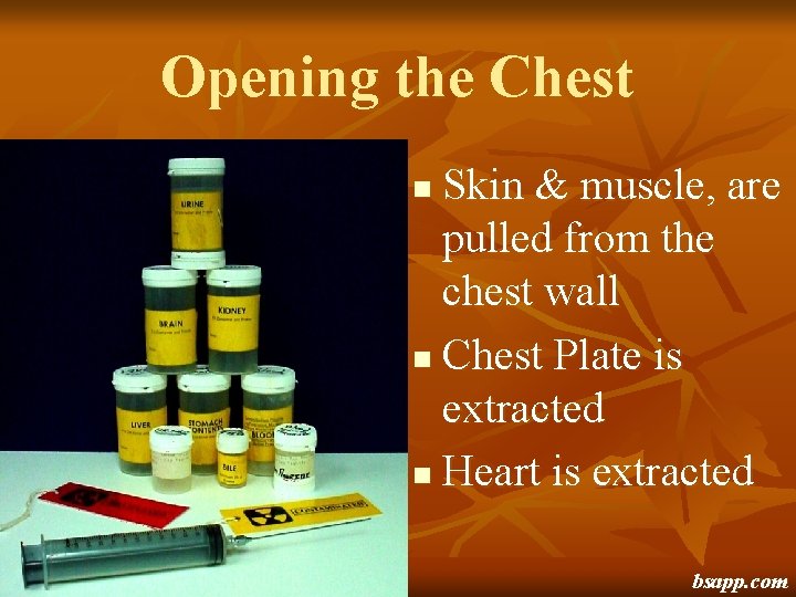 Opening the Chest Skin & muscle, are pulled from the chest wall n Chest