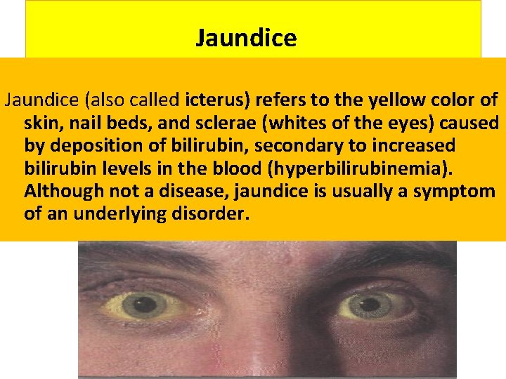 Jaundice (also called icterus) refers to the yellow color of skin, nail beds, and