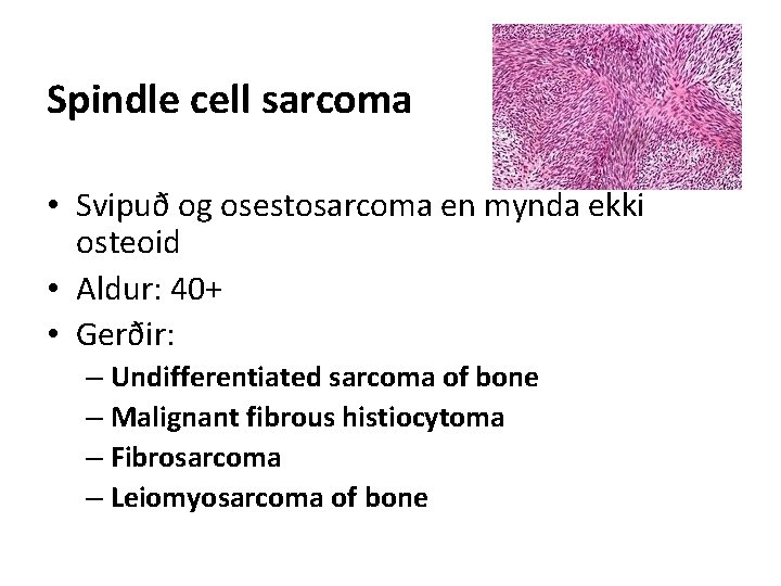 Spindle cell sarcoma • Svipuð og osestosarcoma en mynda ekki osteoid • Aldur: 40+