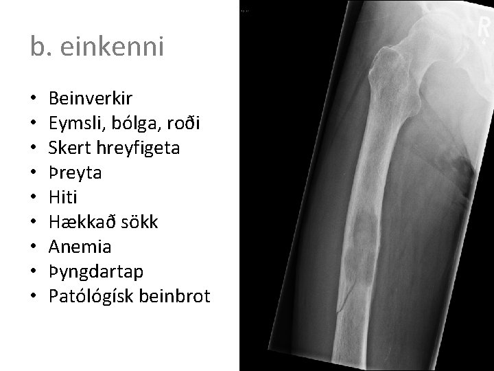 b. einkenni • • • Beinverkir Eymsli, bólga, roði Skert hreyfigeta Þreyta Hiti Hækkað