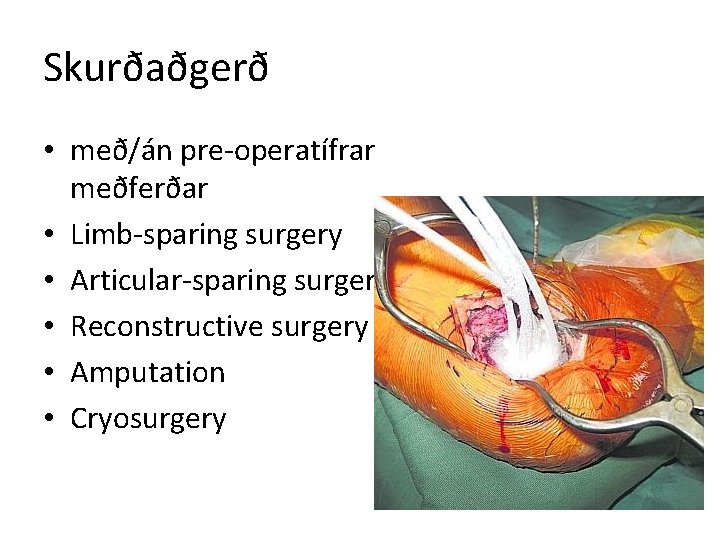 Skurðaðgerð • með/án pre-operatífrar meðferðar • Limb-sparing surgery • Articular-sparing surgery • Reconstructive surgery