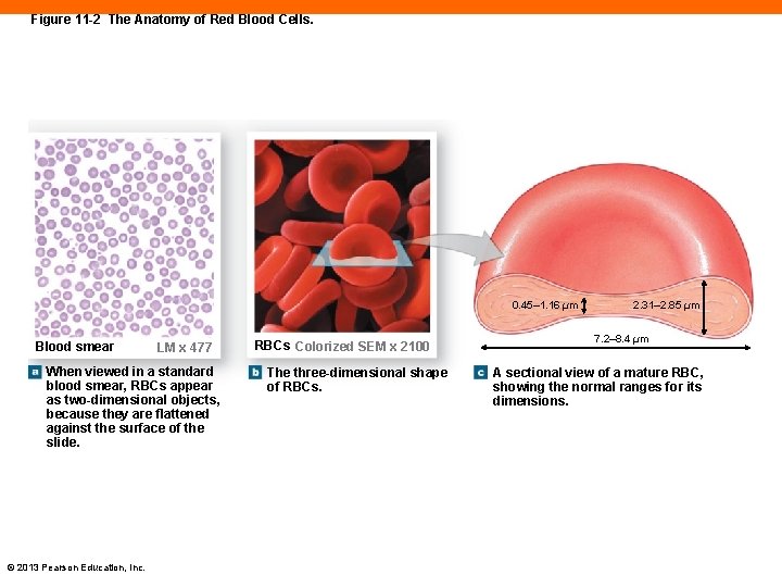 Figure 11 -2 The Anatomy of Red Blood Cells. 0. 45– 1. 16 µm