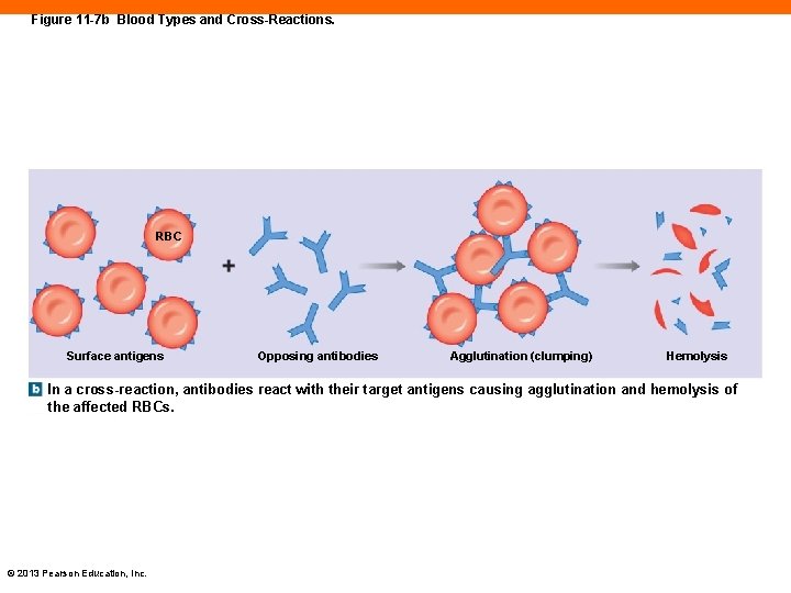 Figure 11 -7 b Blood Types and Cross-Reactions. RBC Surface antigens Opposing antibodies Agglutination