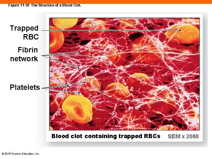 Figure 11 -10 The Structure of a Blood Clot. Trapped RBC Fibrin network Platelets