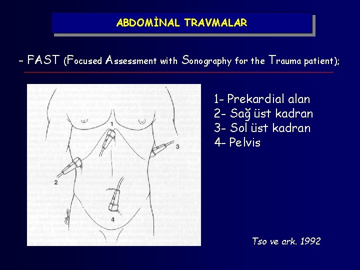 ABDOMİNAL TRAVMALAR - FAST (Focused Assessment with Sonography for the Trauma patient); 1 -