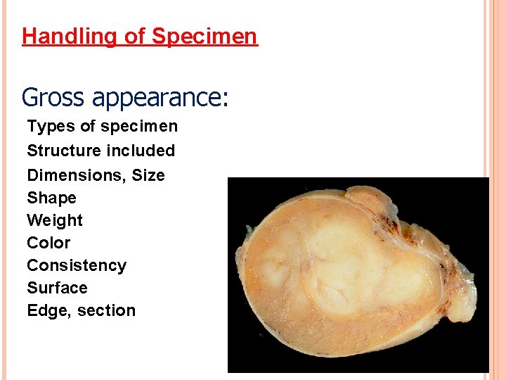 Handling of Specimen Gross appearance: Types of specimen Structure included Dimensions, Size Shape Weight