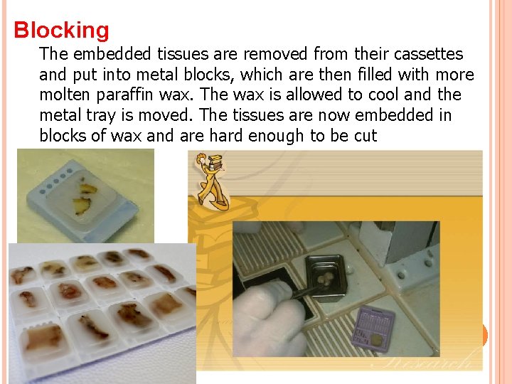 Blocking The embedded tissues are removed from their cassettes and put into metal blocks,