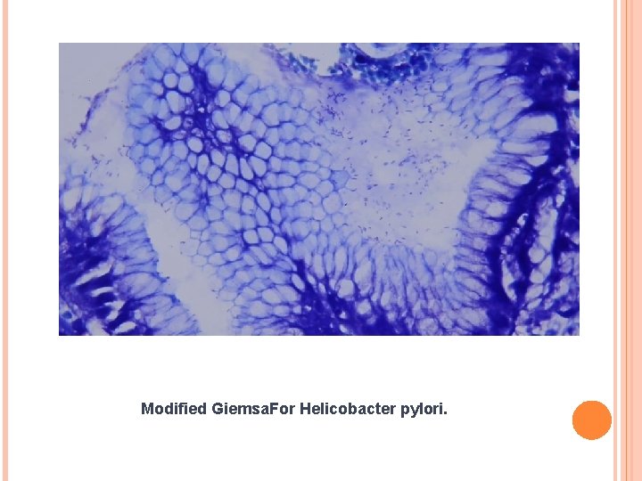 Modified Giemsa. For Helicobacter pylori. 